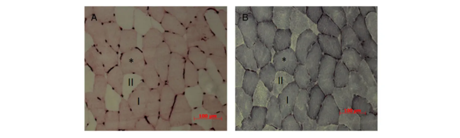 Figure 1 Typical example of serial vastus lateralis muscle sections from an old man stained for (A) myosin heavy chain (MHC) type I (dark stained) and capillaries (dark dots), (B) succinate dehydrogenase (SDH) activity