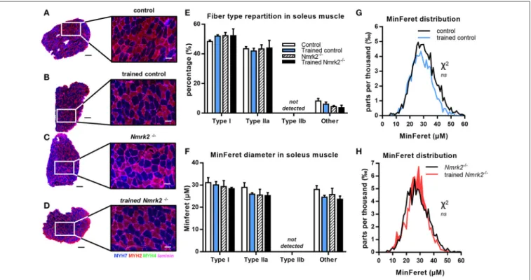 FIGURE 5 | MHC isoforms distribution and MinFeret diameter in soleus muscle. (A–D) Myosin isoforms and laminin immunofluorescence histochemistry [MHC-I (MYH7) in blue, MHC-IIA (MYH2) in red, MHC-IIB (MYH4) in green, laminin in magenta] on 8-µm transversal 