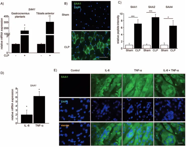 Figure 6. Sepsis and proinflammatory cytokines increase muscular SAA1 expression and protein content in vivo and in vitro 