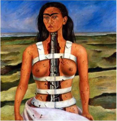 Figure 4 : La douleur physique, La colonne brisée, Frida Kahlo, 1944. 