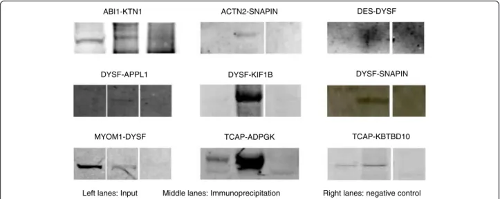 Table 3 Most frequent domains in the LGMD-centered dataset and representativeness in the human proteome