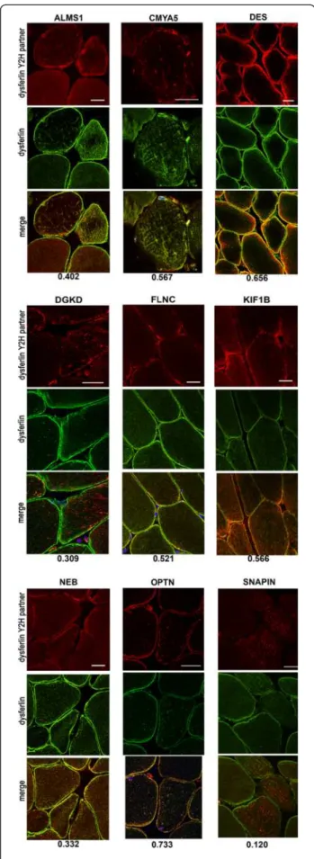 Figure 3 Co-localization analyses of dysferlin and its partners.