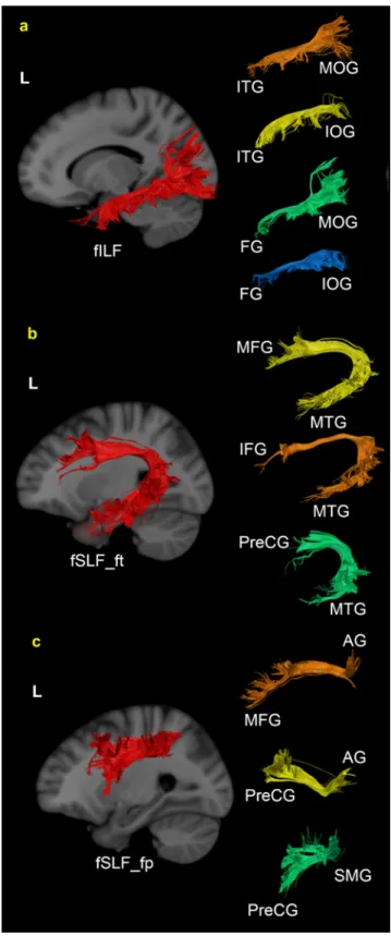 Fig.  3  Example  of  left  fILF  (a),  fSLF_ft  (b),  fSLF_fp  (c)  and  their  sub-tracks  extracted  from  the  whole  brain  tractography of a representative participant