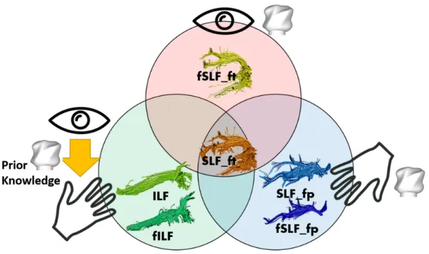 Fig. 2 This figure illustrates the WM tracks involved in multisensory shape processing: Unisensory haptic shape  information is relayed by SLF_fp and fSLF_fp, whereas fSLF_ft processes unisensory visual shape information