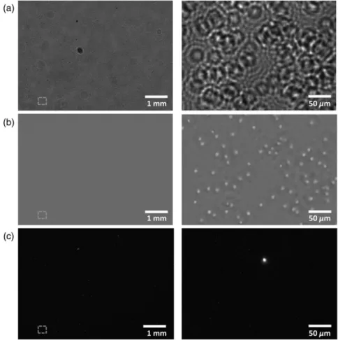 Fig. 8 Multimodal acquisition of whole blood labeled with Thiazole Orange. Full-field images and details of (a) a hologram, (b) the reconstructed phase map, and (c) the fluorescence acquisition.