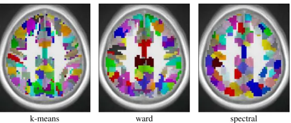Figure 3. Example of parcellation with 500 parcels on the Localizer dataset.