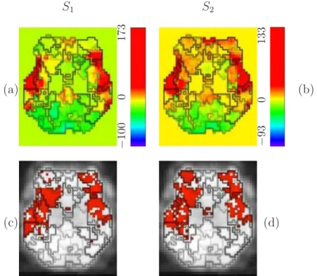 Fig. 10. (a)-(b) NRL estimates in one slice of subject 1’s brain (at z = −4 mm) in response to S 1 (a) and S 2 (b)