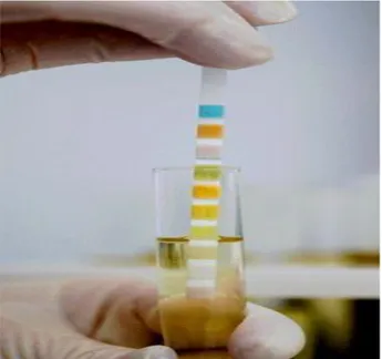 Figure 11 : photos Test biochimique d’urine