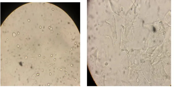 Figure  12.   Observation  microscopique              Figure  13. Observation  microscopique  des        des  hématies  (×40)                                    cellules  épithéliales    (×40)