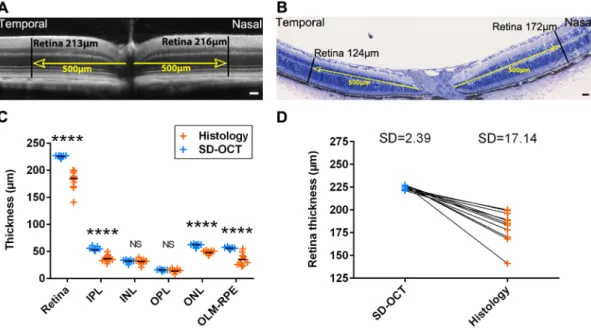 Figure 1. Retinal layer thickness measures in C57BL/6JRj wild-type mice by SD-OCT and histology