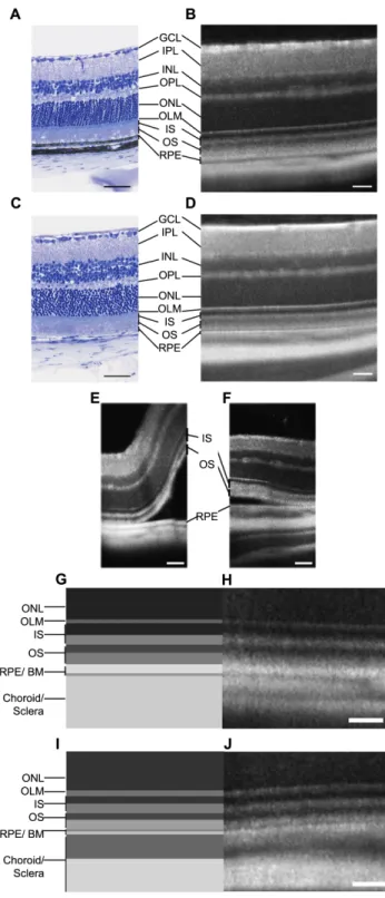 Figure 2. Characterization of pigmented and albino retina layers by SD-OCT. Histological sections of C57BL/6JRj pigmented mouse retina (A) and BALB/cJ albino mouse retina (C)