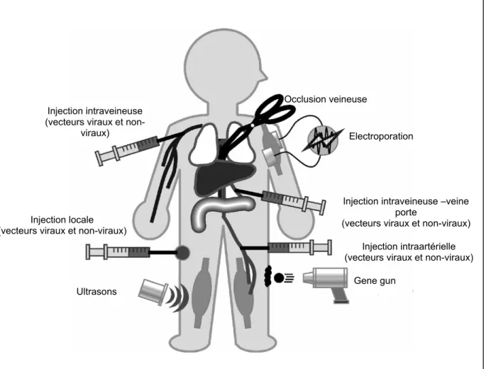 Figure 3 : voies d’administration et méthodes physiques du transfert de gènes  Occlusion veineuse 