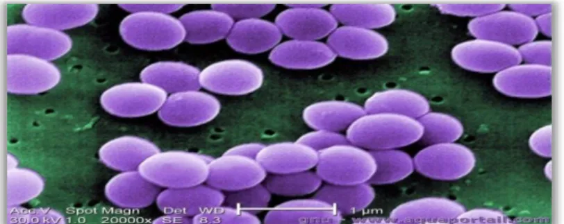 Figure 15 : Aspect morphologique de la souche de Staphylococcus aureus observée au  microscope électronique (Leyral et Vierling, 2007).