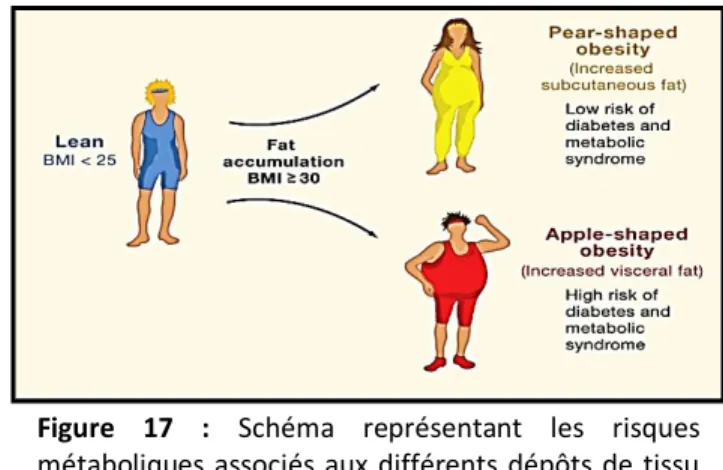 Figure  17  :  Schéma  représentant  les  risques  métaboliques  associés  aux  différents  dépôts  de  tissu  adipeux dans le cadre de l’obésité