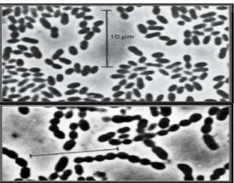 Figure  03  :  Lactococcus  lactis  subsp lactis sous forme de cellules  ovoïdes par paire (photo du haut),  et en chainette (photo du bas) selon  la souche (Teuber et Geis, 2006).