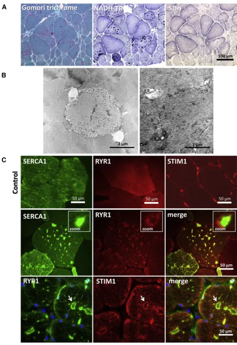 Figure 1. Characterization of Tubular Aggregates in Skeletal Muscle