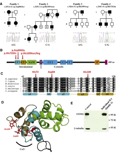 Figure 2. Identification of STIM1 Muta- Muta-tions in Autosomal-Dominant TAM (A) Pedigrees indicate dominant  inheri-tance of TAM, and sequence analysis confirmed the segregation of the  heterozy-gous mutations with the disease.