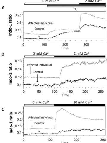 Figure 4. Impact of the STIM1 p.Asp84Gly Substitution on Ca 2þ Homeostasis in TAM Myoblasts