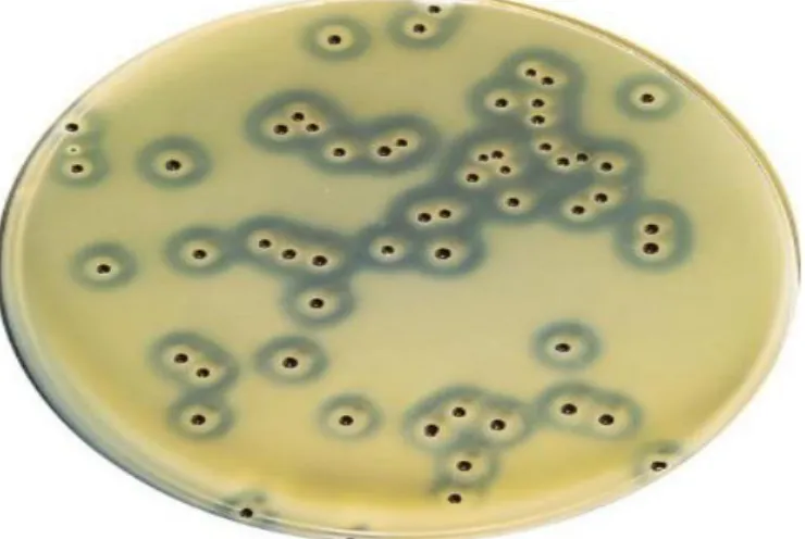 Figure n 0 5: les Staphylococcus aureus sur gélose de BairdPerker(c). 