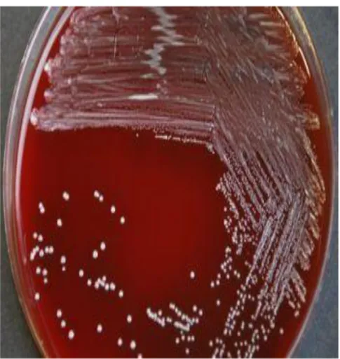 Figure n 0 7:les Arcano bacterium pyogènes sur gélose au sang(e) 