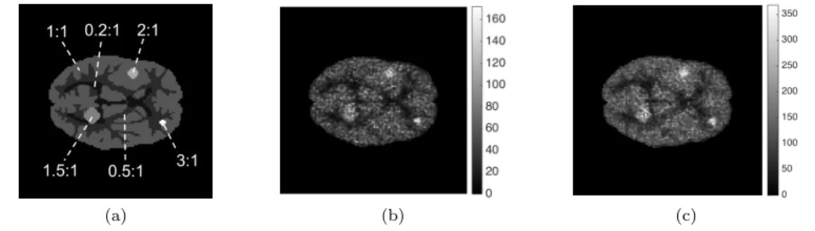 Figure 8: (a) Simulated Hoffman phantom activity distribution with activity ratios, (b) Reconstructed NIBEM central image when 3M counts were simulated, (c) Reconstructed NIBEM central image when 9M counts were simulated.