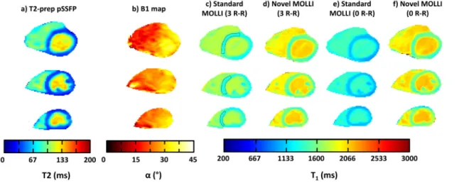 Fig 8. In vivo T2 and B1+ maps obtained using T2-prepared TrueFISP and Bloch-Siegert sequences, respectively (a and b)