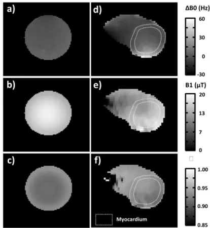 Fig 4. B0 (a,d) and B1+ (b,e) maps acquired respectively on the 2.2L agar phantom and on one of the volunteers