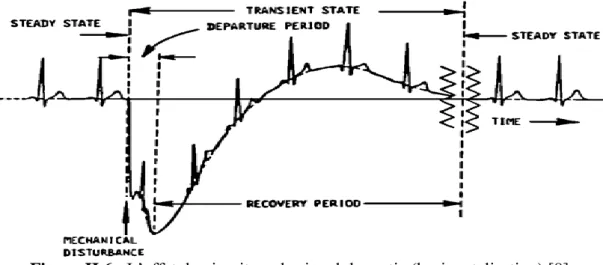 Figure II.6 : L’effet du circuit sur le signal de sortie (horizontalisation) [8]. 