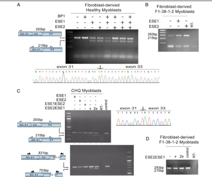 Figure 2. Dysferlin exon 32 skipping analysis. A: RT-PCR analysis of the transcript region flanking exon 32 (exons 30–33) in control fibroblast- fibroblast-derived myoblasts