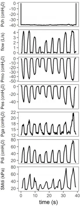 Figure 5. Typical measurements during ventilation against inspiratory threshold loading in participant #1