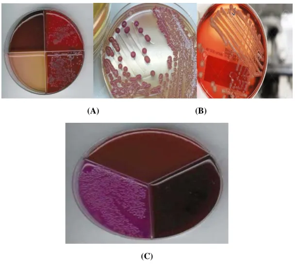 Figure 10 : Tests d’identification sur gélose  ( Rüegg P. 2011).