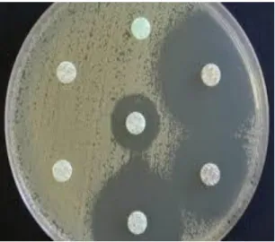 Figure 12 : Exemple d’antibiogramme  (  Madec  JY, 2011 ).