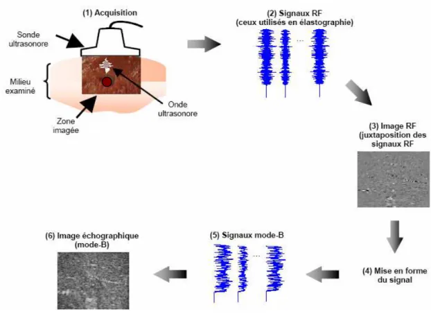 Figure 1.8 : les étapes de formation d’une image échographique. 