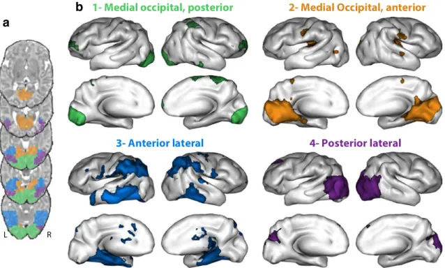 Fig. 1    Clustering of ventral visual cortex according to long-distance  whole-brain functional correlations in newborns