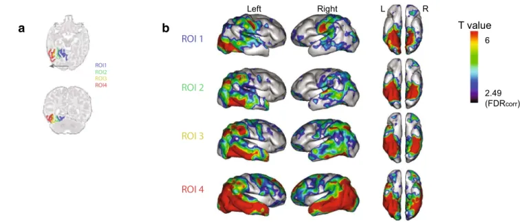 Fig. 2    Functional  connectivity  of  the  four  ROIS  located  along  the  medial–lateral  axis