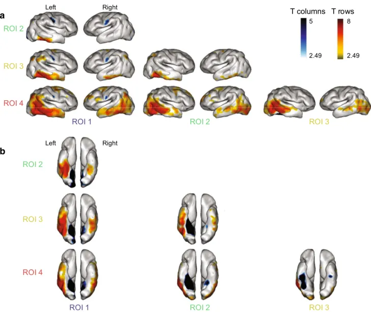 Fig. 3    A mesial-lateral gradient of functional correlation in the infant  ventral  visual  cortex