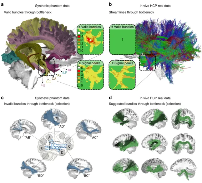 Fig. 8 Bottlenecks and the fundamental ill-posed nature of tractography. a Visualization of six ground truth bundles converging into a nearly parallel funnel in the bottleneck region of the left temporal lobe (indicated by square region)