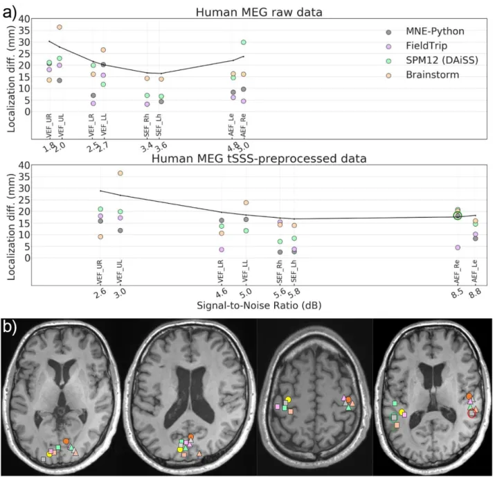 Fig. 8. Source estimates of human MEG data. (a) Localization difference from the reference dipole  location for raw and preprocessed data