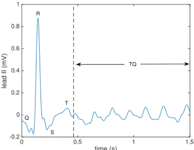 Fig. 2. Synthetic data experiments: influence of BTD matrix factor rank L.