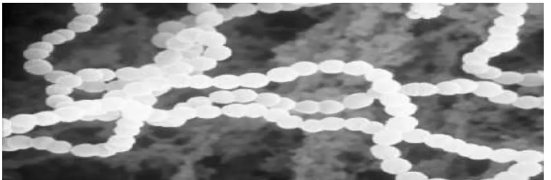 Figure 4:Observation au microscope électronique à balayage de Streptococcus thermophilus  (GX7000) (Vendramin et al