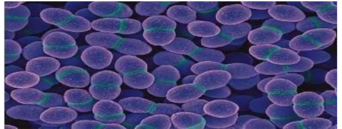 Figure 5:Observation au microscope électronique Enterococcus faecium (GX4000)  (Kokkinos et al