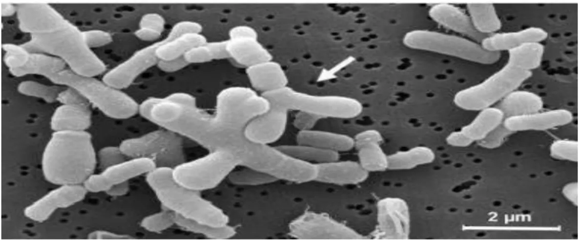 Figure 6:Observation au microscope électronique à balayage de Pediococcus acidilactici  (GX10000) (Cho et al