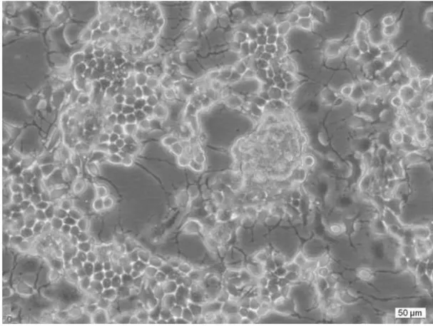 Figure 34.  Cellules CAD différenciées dans un milieu sans sérum montrant de longs axones