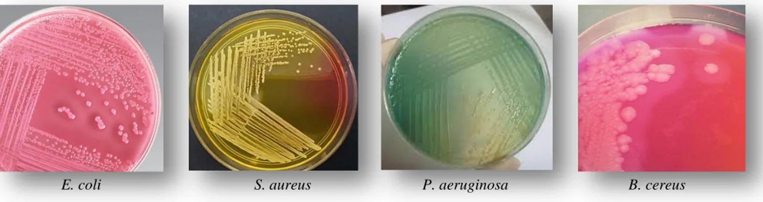 Figure 14. Aspect macroscopique des 04 souches isolées dans leurs milieux sélectifs. 