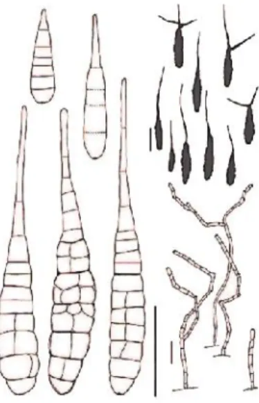 Fig 10 : conidies et conidiophores de A.solani (simmons,2007)