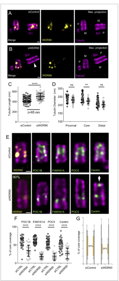 Figure 4. WDR90 is crucial for inner scaffold components localization (see also Figure 4—figure supplement 1).