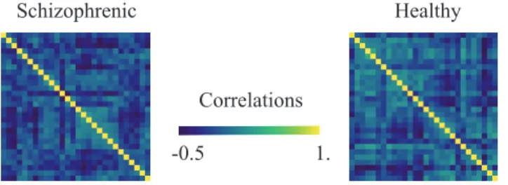 Fig. 5: Subset of the connectomes dataset, available in geomstats with the function load_connectomes from the  mod-ule datasets.utils 