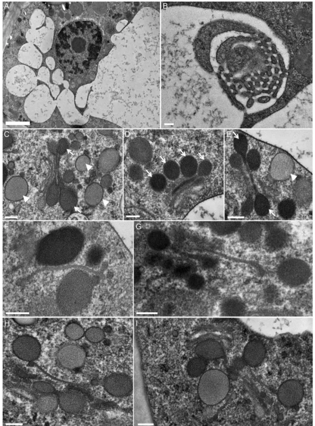 Fig. 6. TEM micrographs of secretory cell ultrastructure 1–2 days after stimulation. (A) Main convoluted vacuole giving rise to interconnected or isolated subcompartments