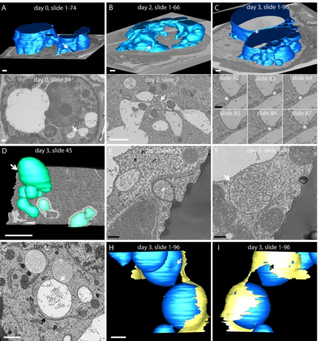 Fig. 8. 3D rendering from array tomography data. (A)–(C) Comparison of the main vacuole 3D structure at the three time points of secretion