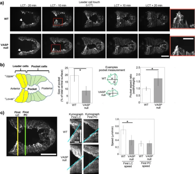FIGURE 2:  VASP affects lamellipodial actin dynamics during ventral enclosure. (a) Imaging of Lifeact-GFP expressed  exclusively in epidermal cells during ventral enclosure for wild-type embryos and for embryos lacking VASP